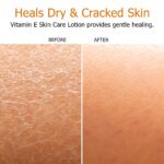 Fruit of the Earth Vitamin E Lotion, 16 Ounce - Image 2